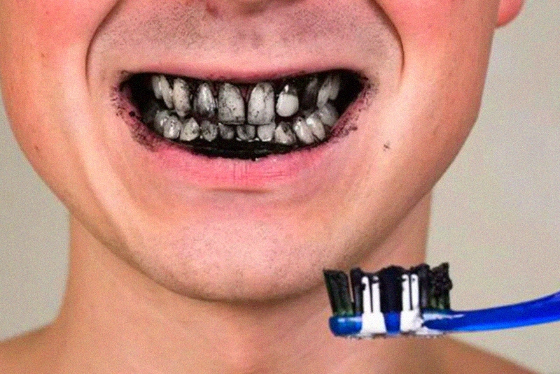Как отбелить зубы в домашних условиях, 5 простых способов?